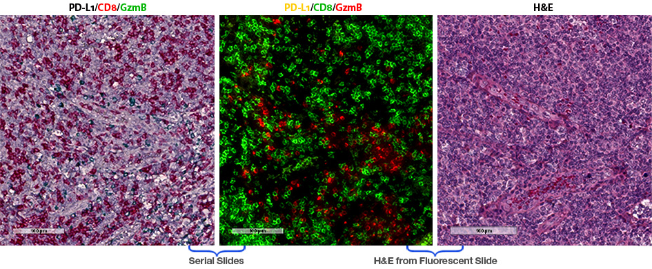 Multiplex IHC and IF images on serial section of
                                    tonsil with the PD-L1/CD8/GranzymeB three-plex as well as H&E staining of multiplex IF slide following removal of its coverslip.